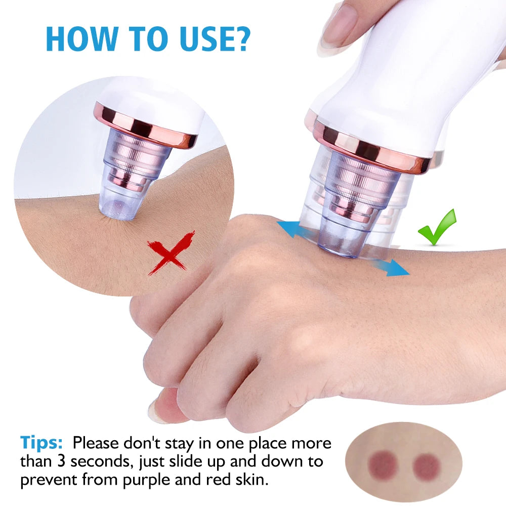 Vacuum Blackhead Removal Facial Cleansing Black Spots Suction 7
