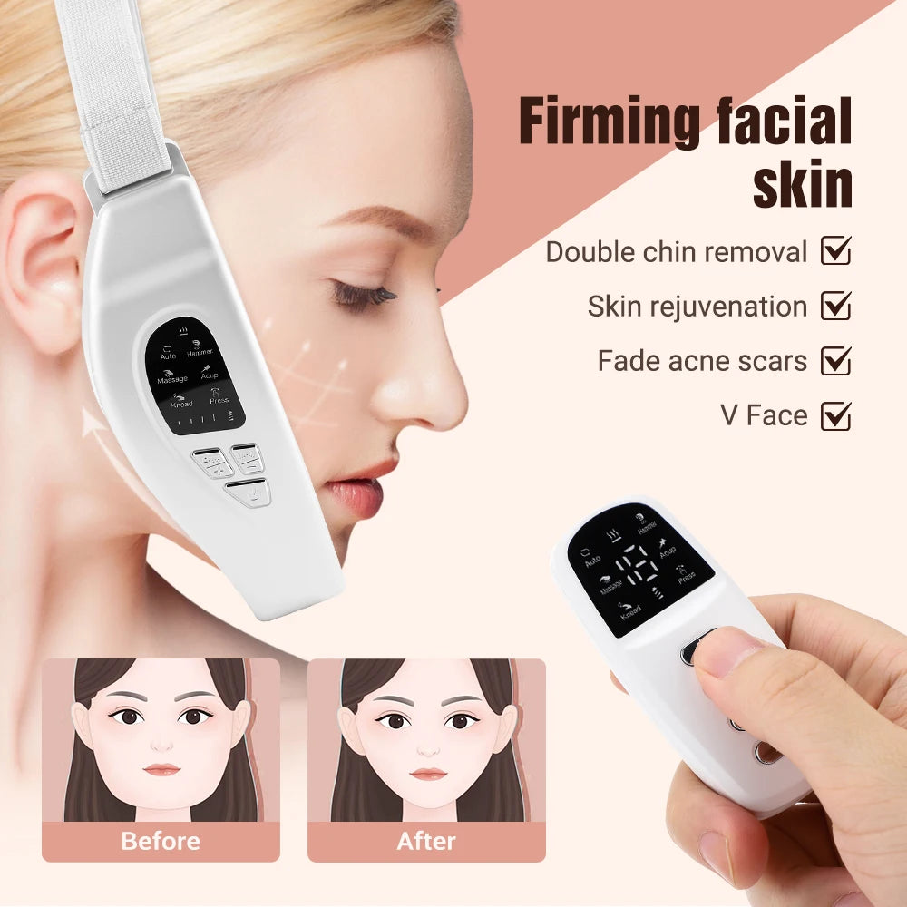 Electric Face Lifting Device LED Lights Heating Vibration Facial