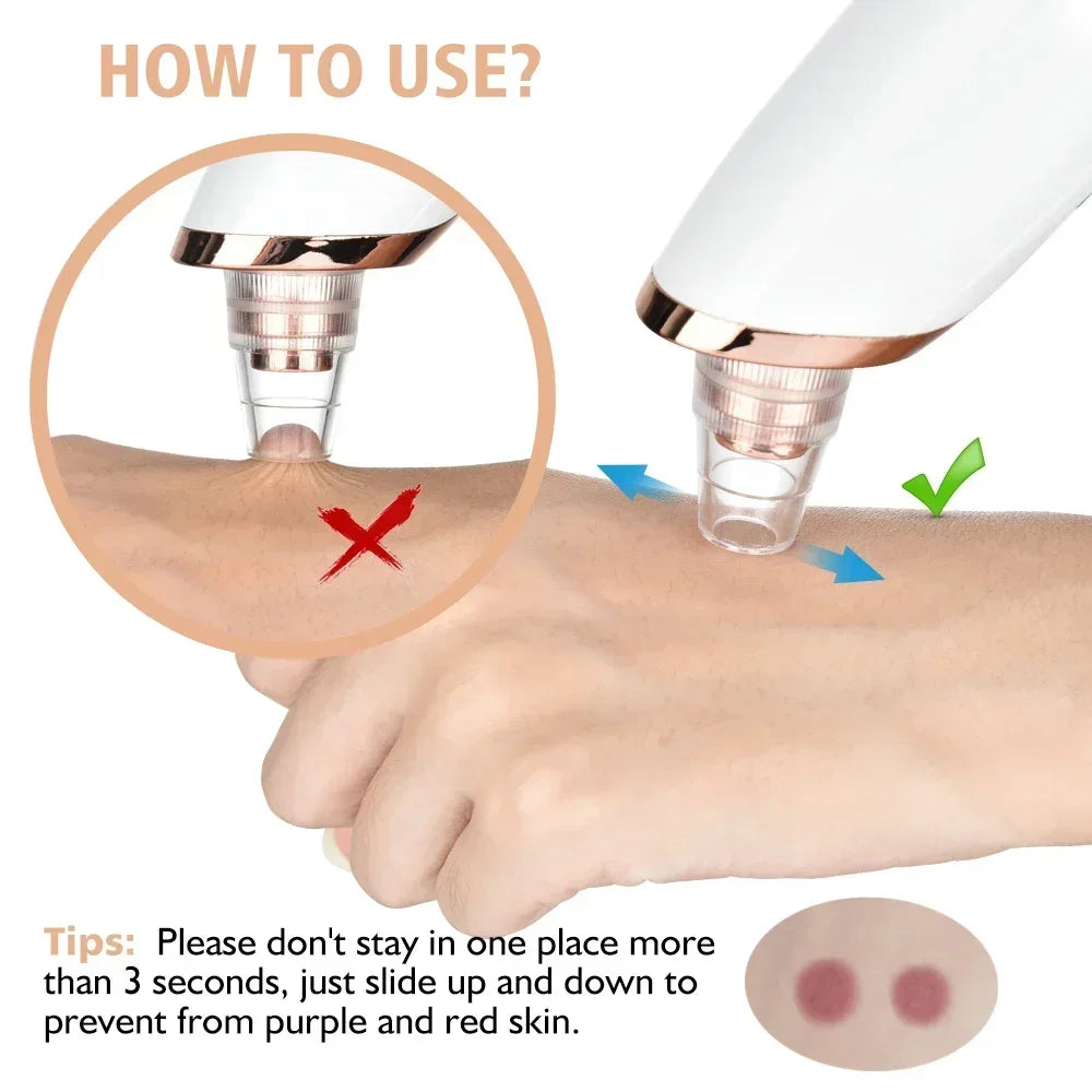 Electric Blackhead Remover Vacuum Suction Facial Pore Cleaner