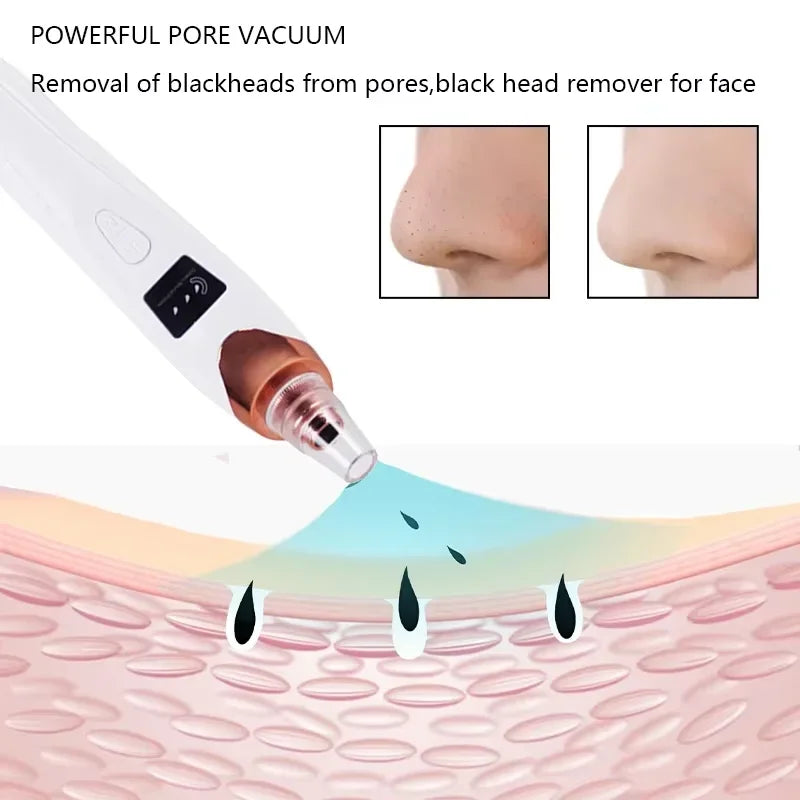 Electric Blackhead Remover Vacuum Suction Facial Pore Cleaner