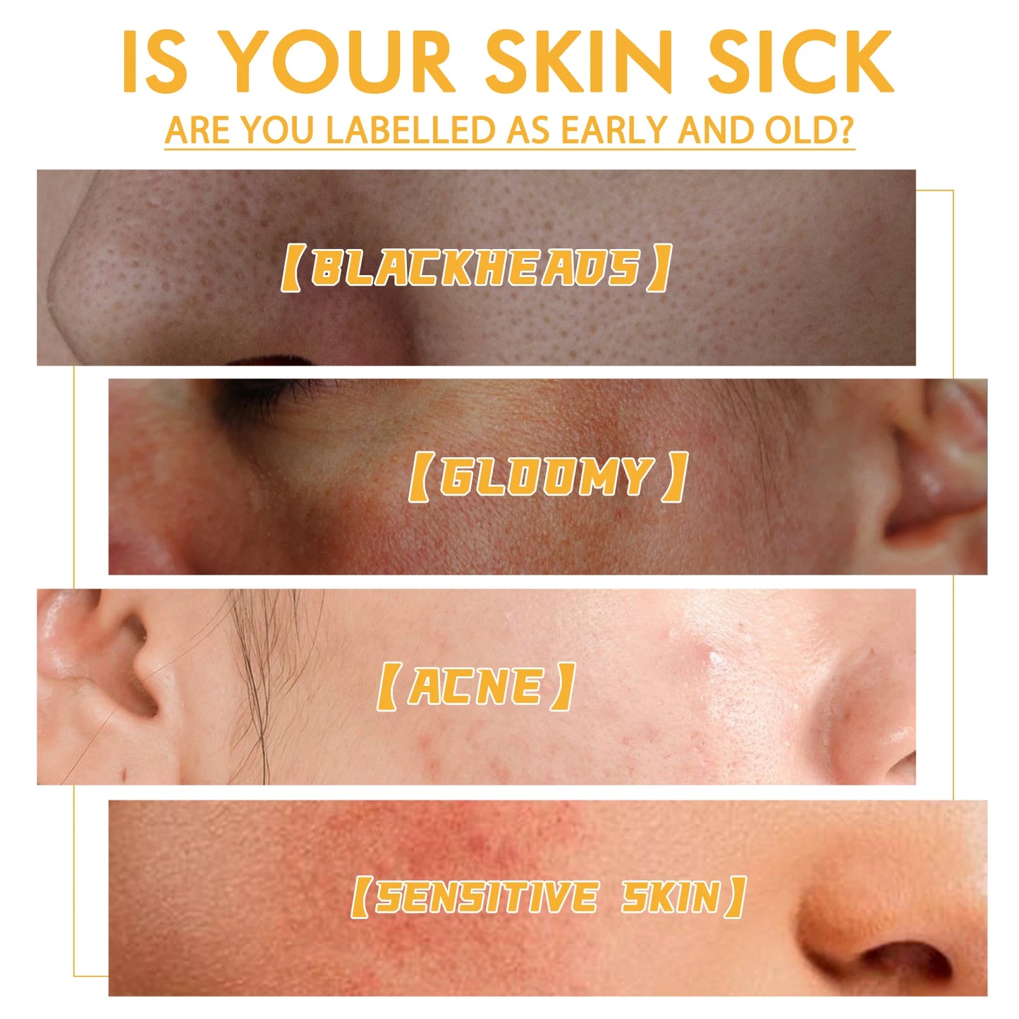Honey Peeling Mask Deep Cleansing Remove Blackheads