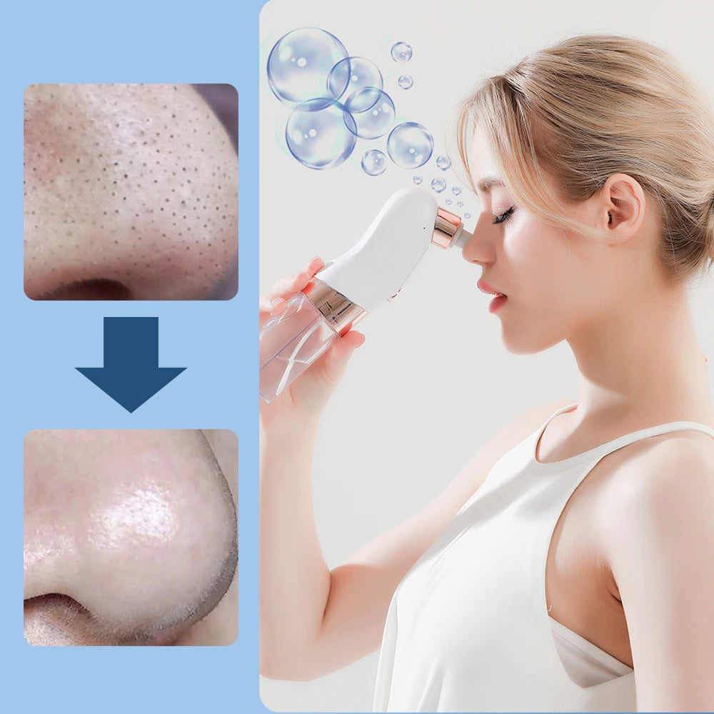 Blackhead Remover Upgraded Small Bubble 3 Level Electric Slant Screen
