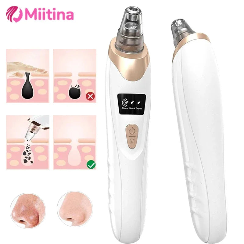 Electric Blackhead Remover Vacuum Suction Facial Pore Cleaner