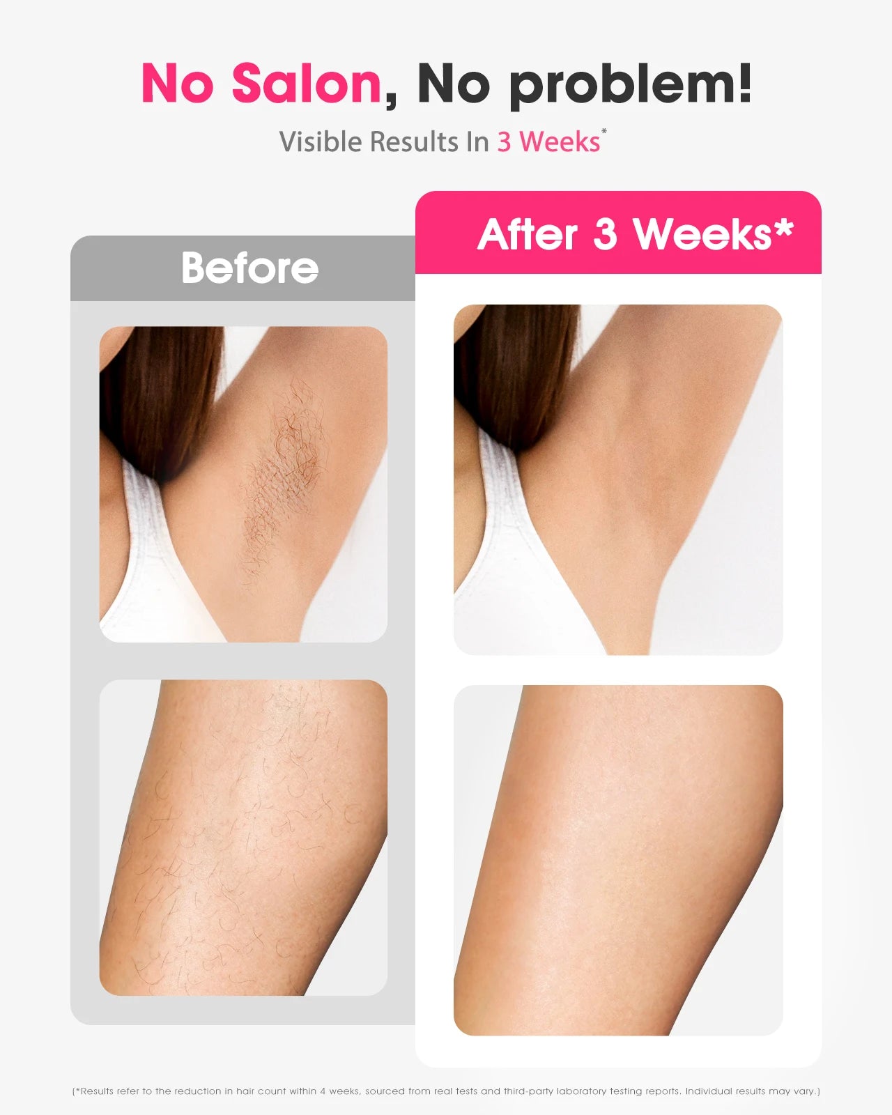 Painless Laser  Epilator Women Shaver Permanent Hair Removal